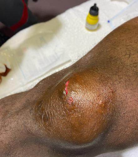 开云-首红！赵宏略“废人式”飞踹巴索戈 中超新恶人诞生？